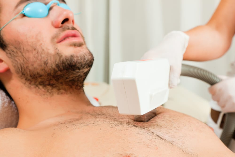 Conheça os tipos laser para homens